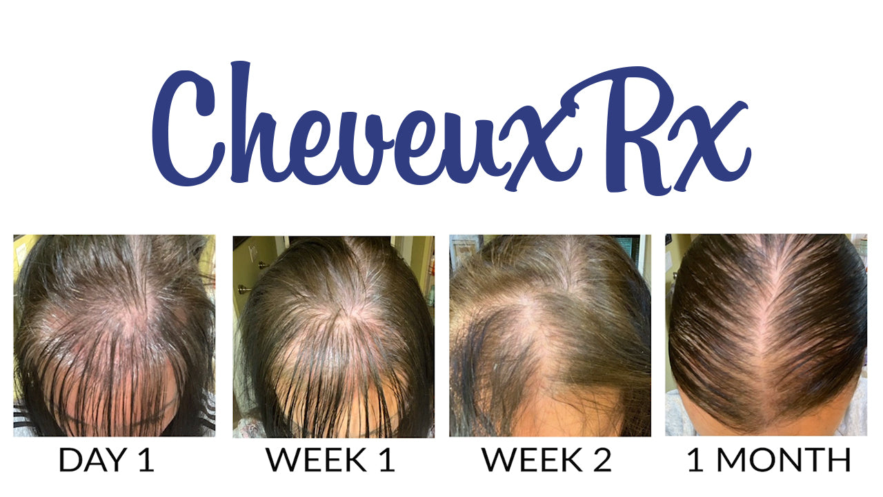 Hair Growth Transformation With CheveuxRx Hair Vitamins