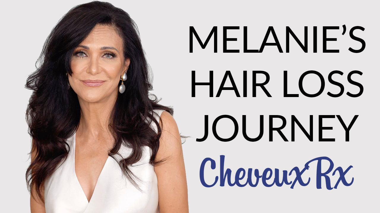 Melanie's Thinning Hair And Hair Loss Journey